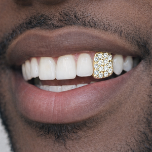 Single Tooth Micropavé CZ Gold Grillz – Iced Out Cubic Zirconia Front Tooth & Canine Dental Jewelry